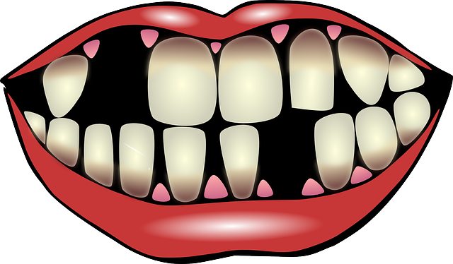 5 raisons principales de remplacer vos dents manquantes
